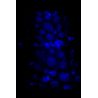 MadPax Bubble Full (Galaxy)